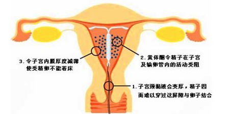 子宫肌瘤多大必须手术切除需要休息多久