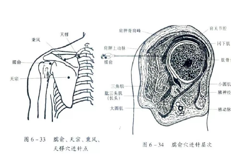 手臂疼痛