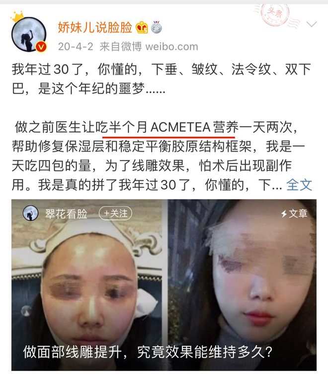 做完线雕后注意事项千万别不当回事